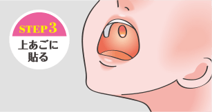 大鵬薬品ピタスシリーズ　口腔内貼付フィルム　使用手順