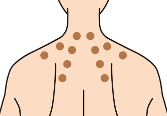 日本藥妝推薦 穴道貼貼法 興和