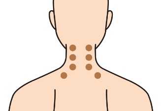 日本藥妝推薦 穴道貼貼法 興和